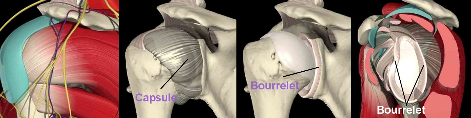 Instabilité et luxation de l'épaule - Dr Yves ROUXEL