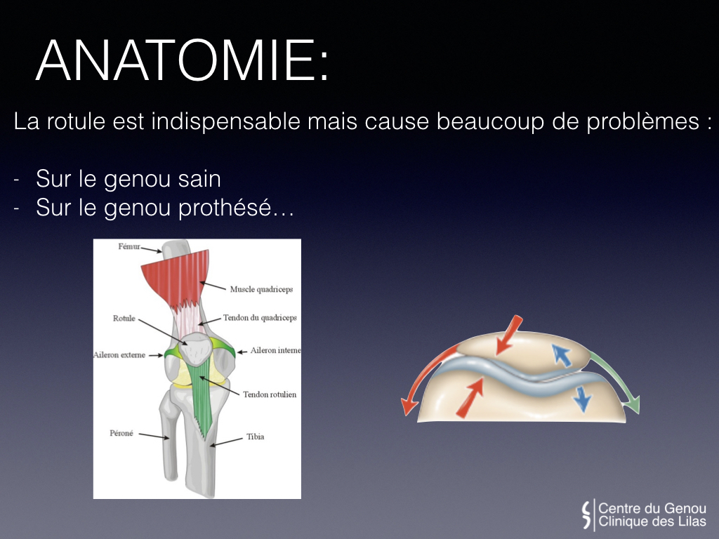 Douleurs et Instabilité de la rotule - Dr Yves ROUXEL
