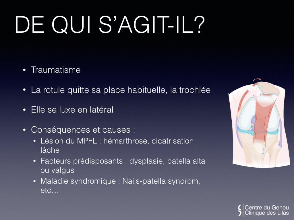 Douleurs et Instabilité de la rotule - Dr Yves ROUXEL