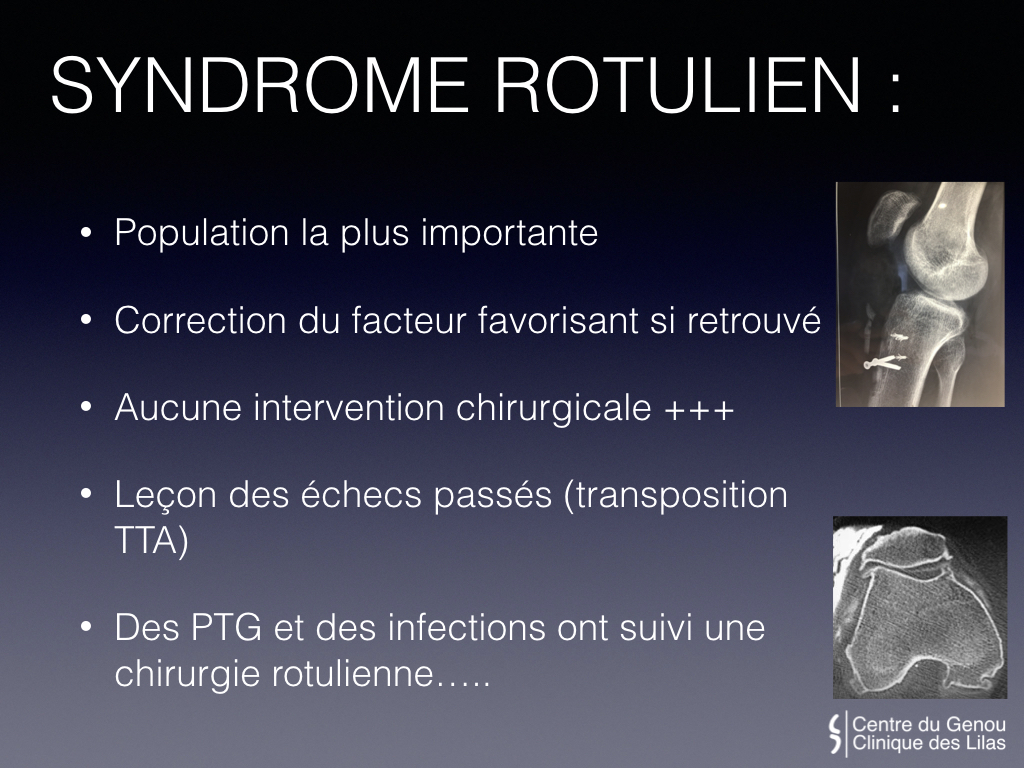 Douleurs et Instabilité de la rotule - Dr Yves ROUXEL